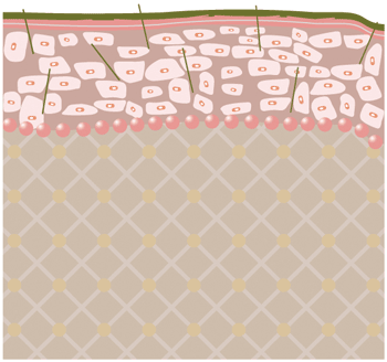 リベルのメカニズム